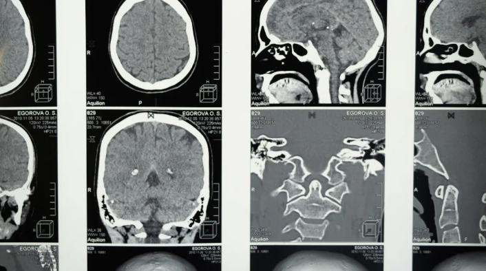 الموجات فوق الصوتية مقابل التصوير بالرنين المغناطيسي مقابل الأشعة المقطعية.png