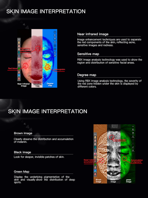 أبيض بالجملة 3D Ios Ai محلل البشرة الذكي للسبا