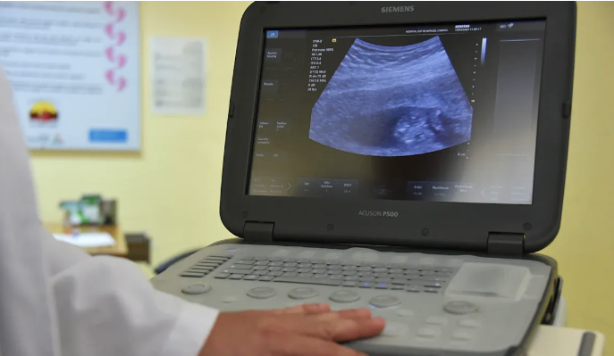 ما هي الموجات فوق الصوتية وكيف تعمل.png