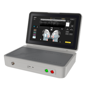 Machine professionnelle HIFU de rajeunissement de la peau &agrave; ultrasons focalis&eacute;s de haute intensit&eacute; AM-G820